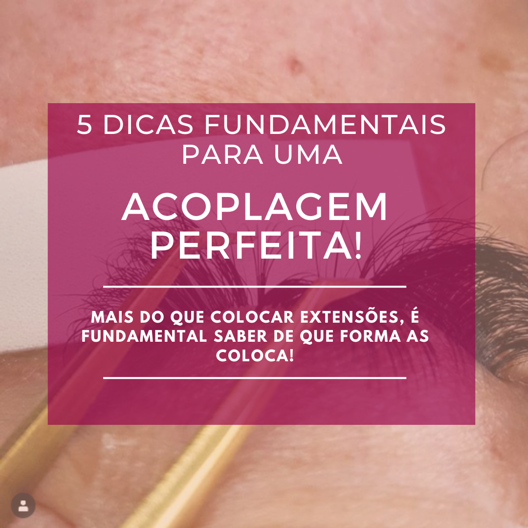 5 Dicas Fundamentais para uma Acoplagem perfeita!